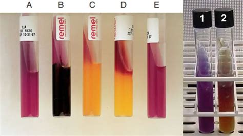 lysine decarboxylase test results|Lysine Iron Agar (LIA): Principle, Composition, .